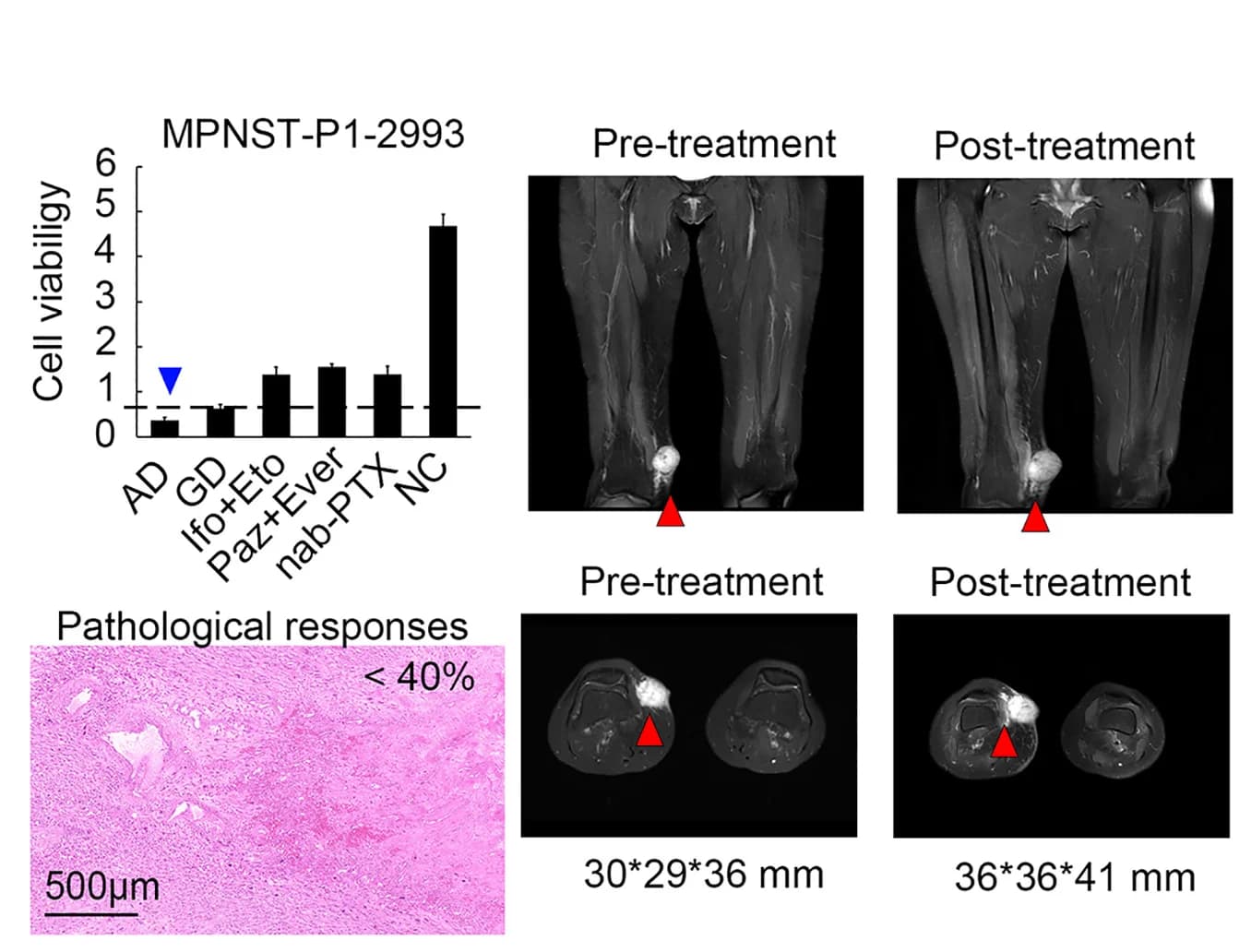 Open access visualization of Bar Plot, Microscopy, Photo, Drug-Response Profile, PTCs