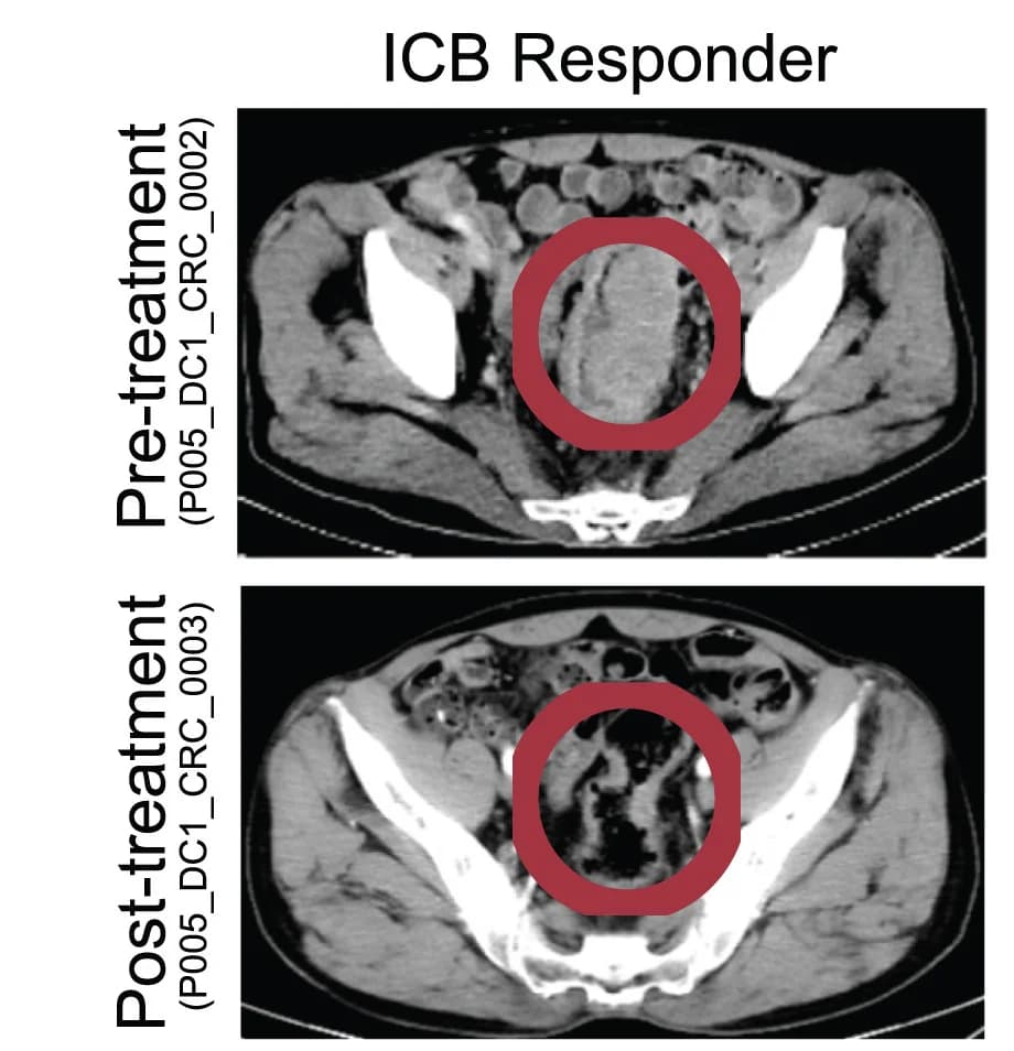 Open access visualization of Photo, Tomographic Images, CRC Responder, ICB Treatment