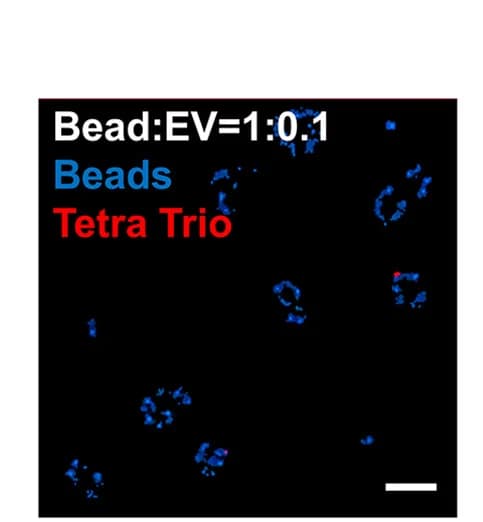 Open access visualization of Microscopy, Fluorescence Microscopy, L1EVs, Immunocapture, Serum