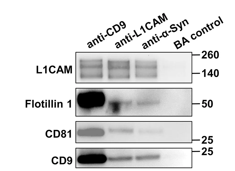 Open access visualization of Gel, Immunocapture, CD9, L1CAM, Alpha-Synuclein