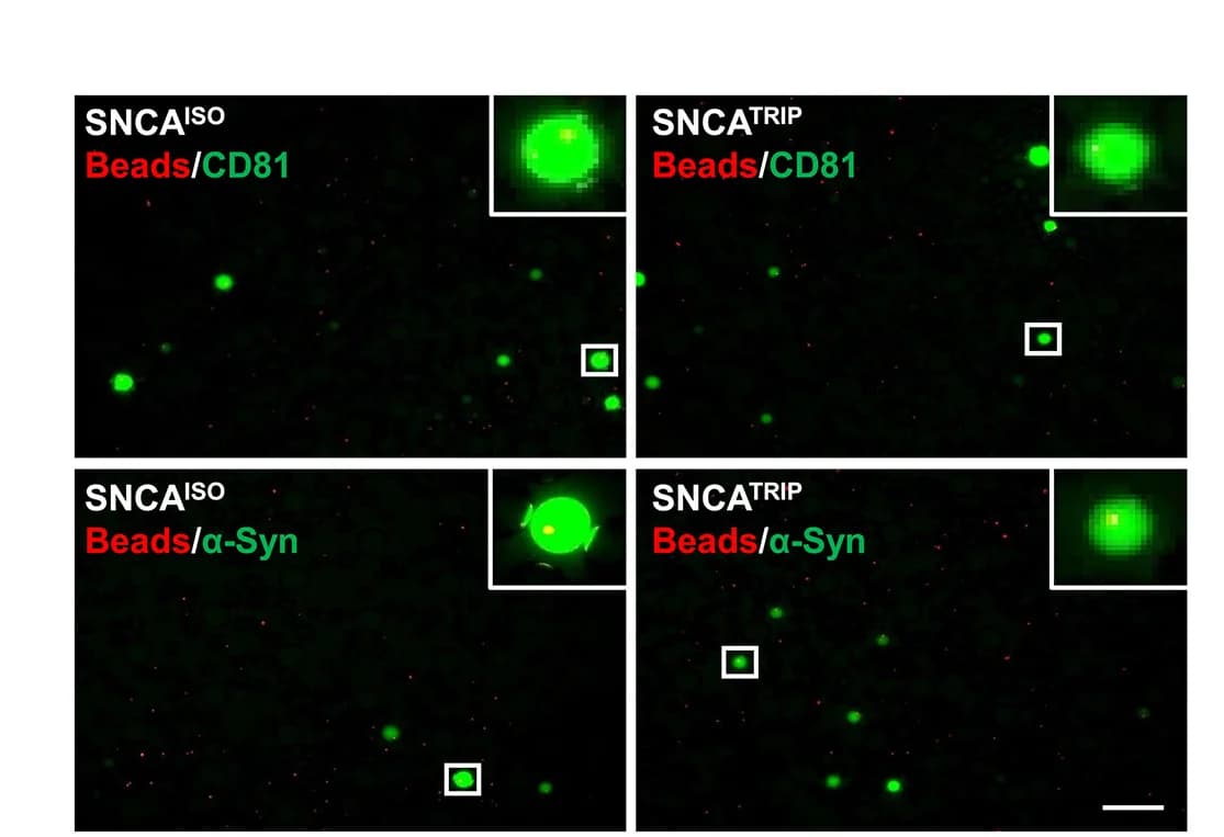 Open access visualization of Microscopy, Membrane-associated Alpha-Synuclein, CD81, L1EVs, Neuronal CM