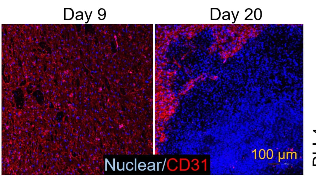 Open access visualization of Microscopy, PECAM1 Immunostaining, AECs, Cell Culture