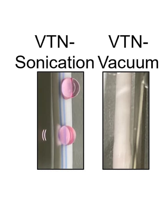 Open access visualization of Photo, Vitronectin, Sonication, ePTFE, Vacuum