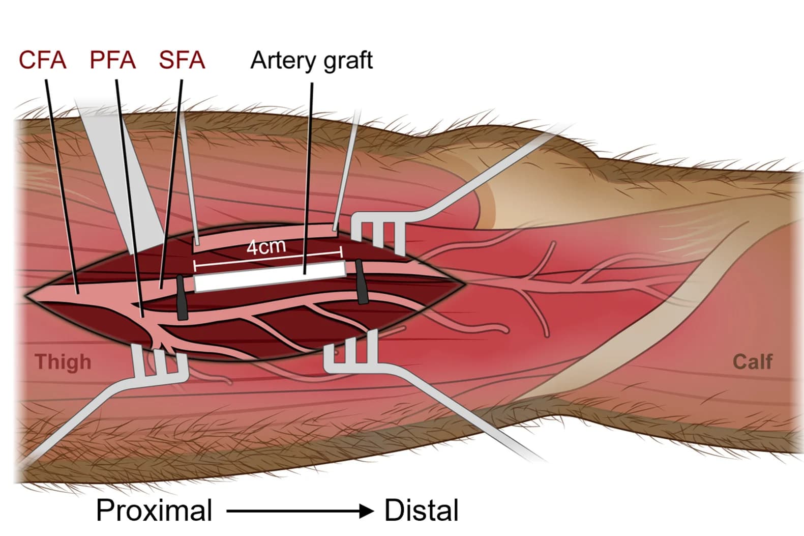 Open access visualization of Illustration, Artery Graft, Bypass Surgery, Rhesus Monkey, Femoral Artery