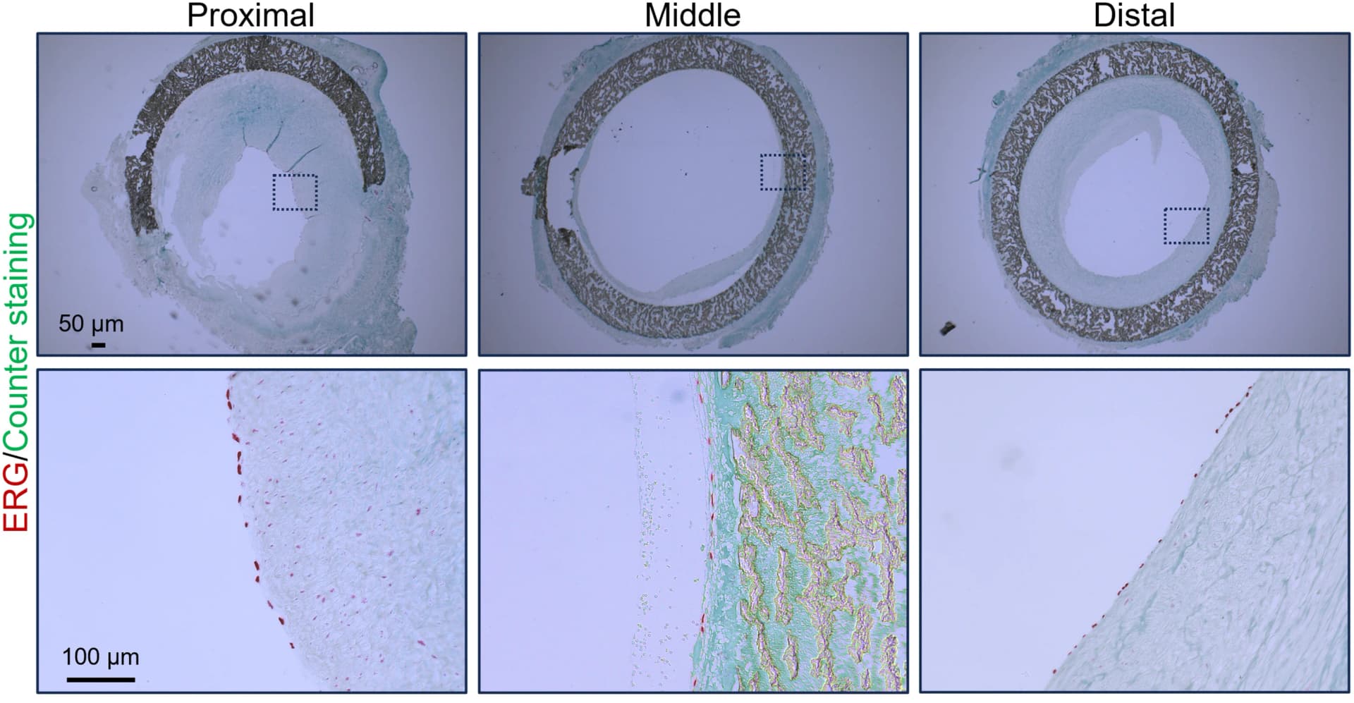 Open access visualization of Microscopy, Immunostaining, Endothelium, ERG