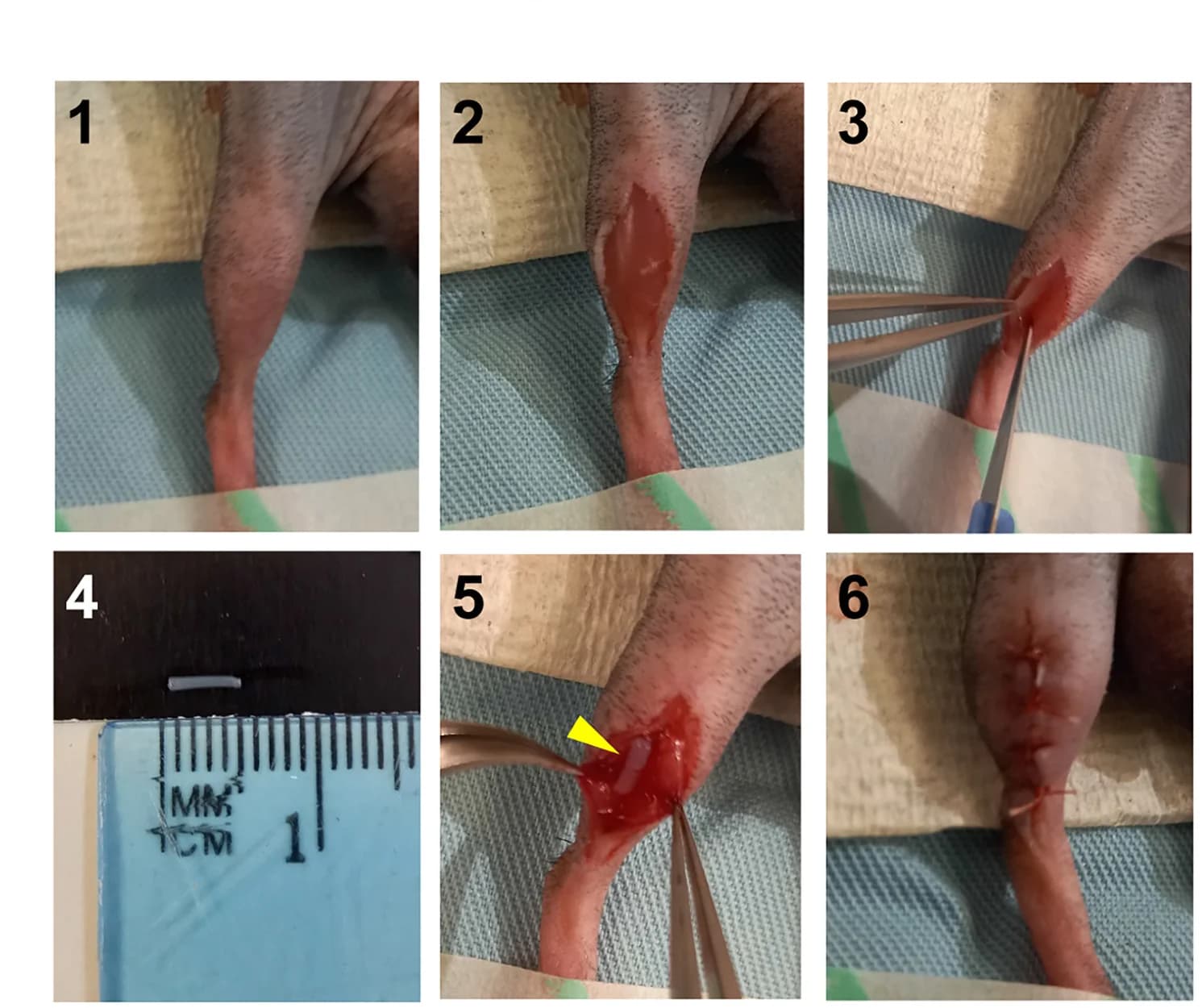 Open access visualization of Photo, Transplantation, Hydrogel, Cell encapsulation, TA Muscle