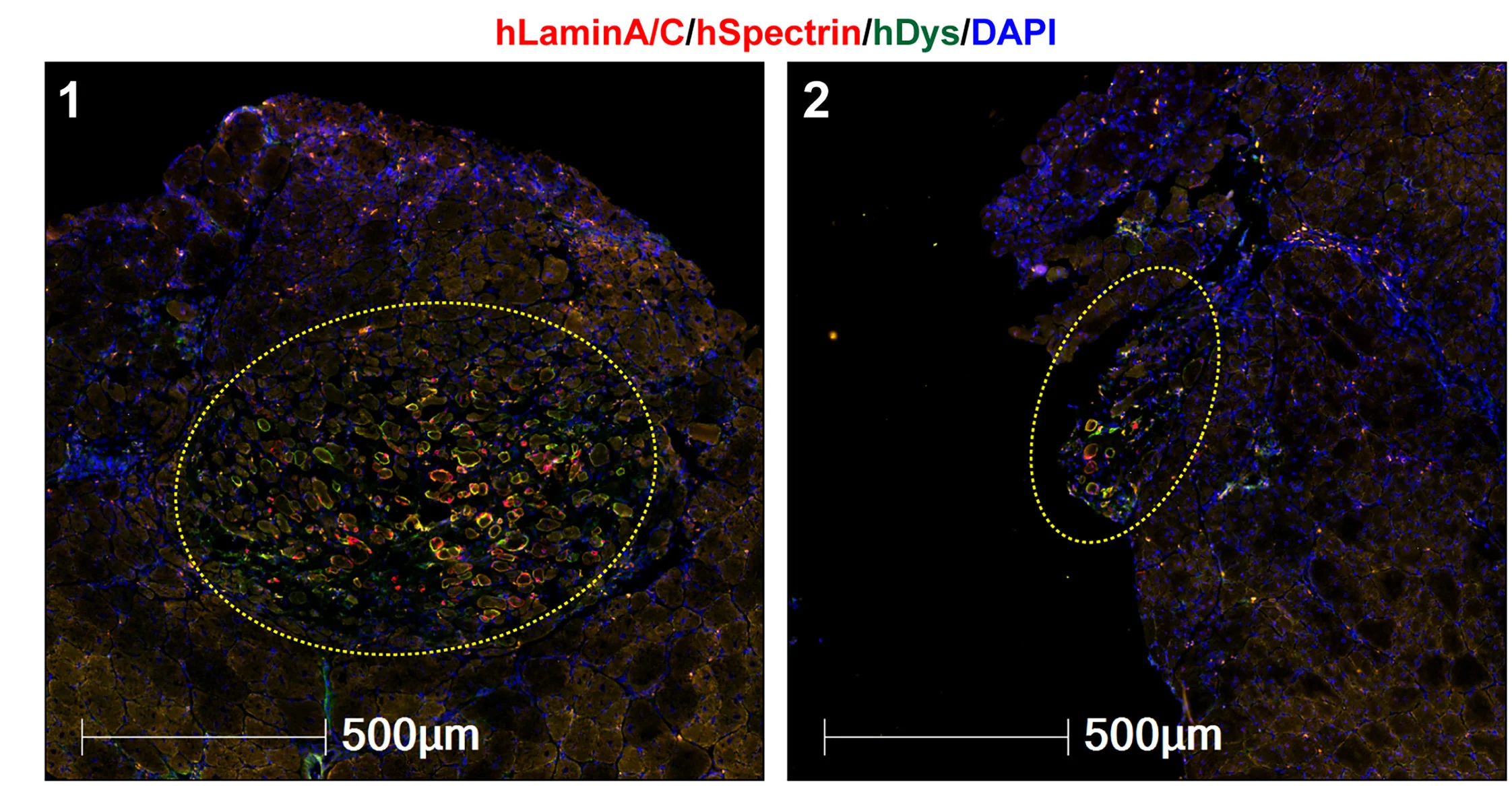 Open access visualization of Microscopy, Hydrogel, Engraftment, Human Myogenic Cells, TA Muscle