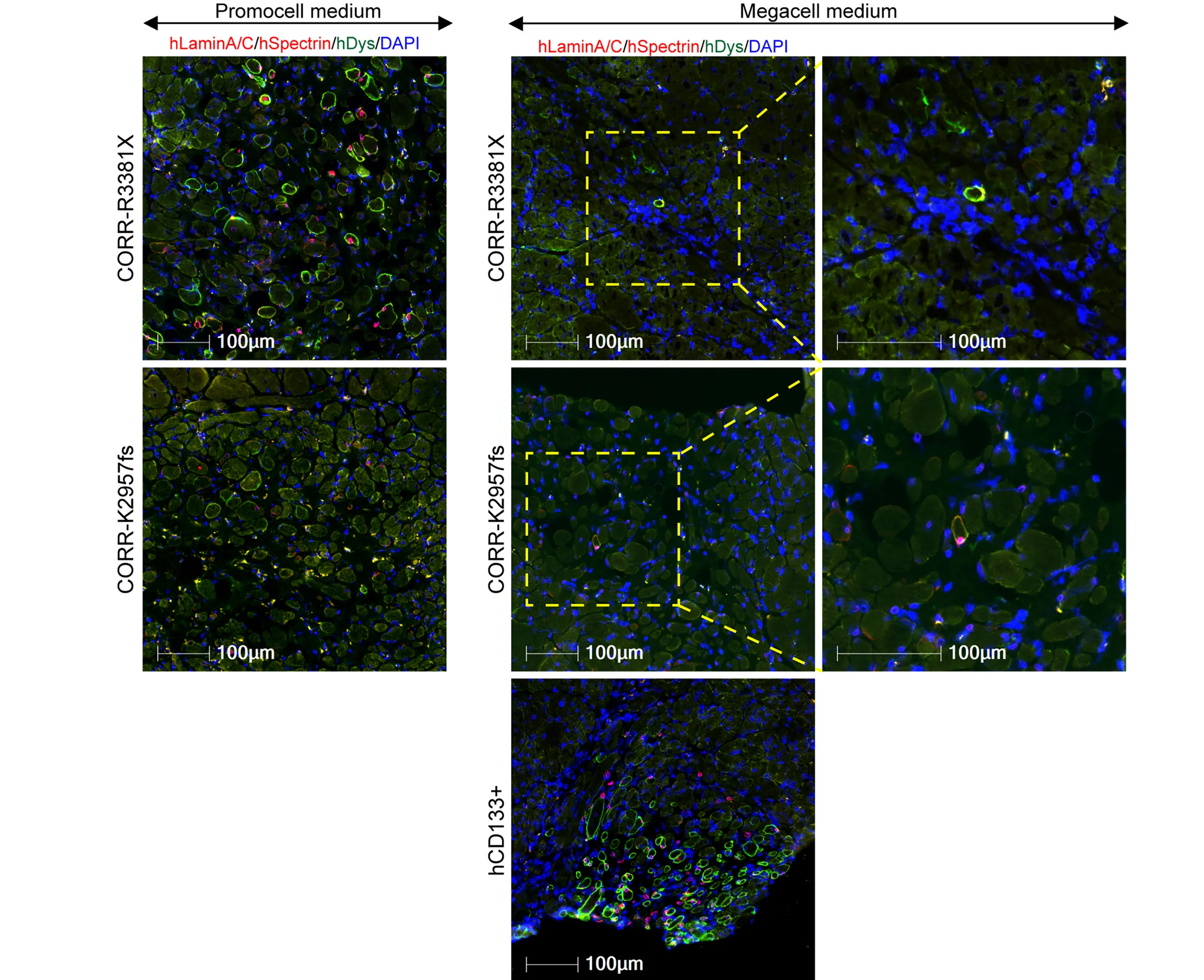 Open access visualization of Microscopy, Cryosections, TA Muscle, 3D Constructs, MPCs