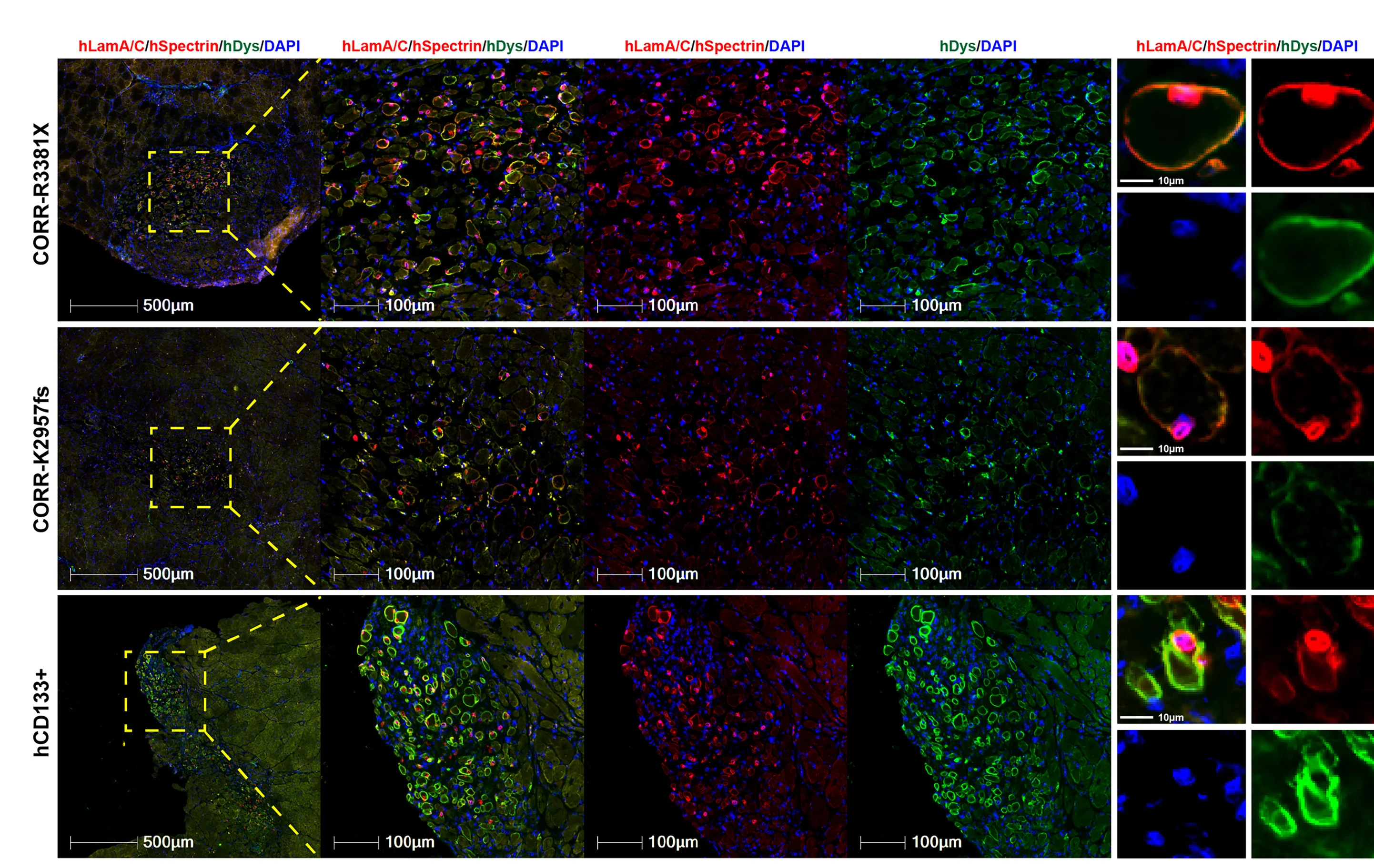 Open access visualization of Microscopy, Cryosections, Human Myofibers, MPCs, Growth Medium
