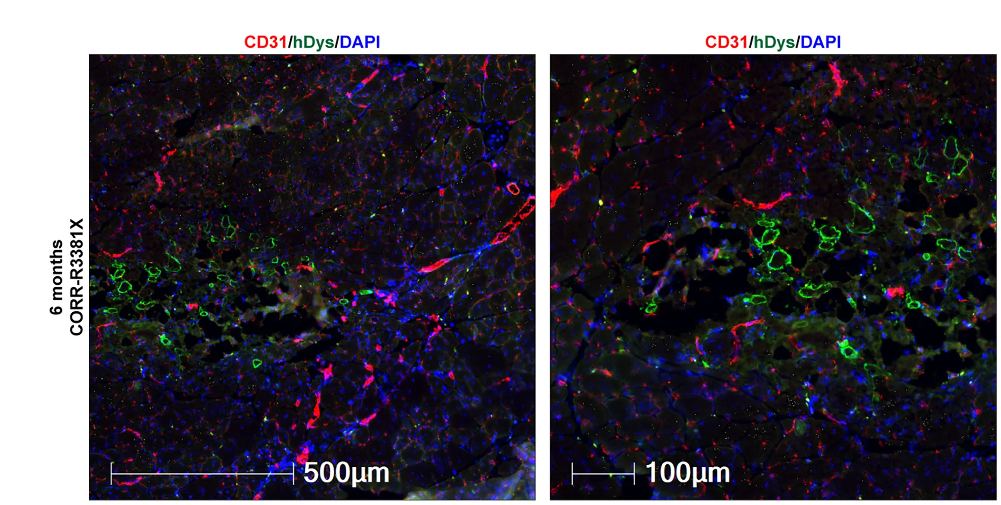 Open access visualization of Microscopy, Vascularization, Blood Vessels, CD31, Human Myofibers