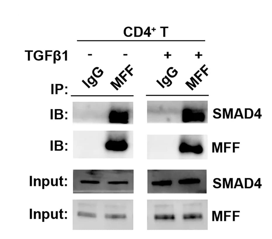 Open access visualization of Gel, Immunoprecipitation, MFF, CD4+ T Cells, PBS