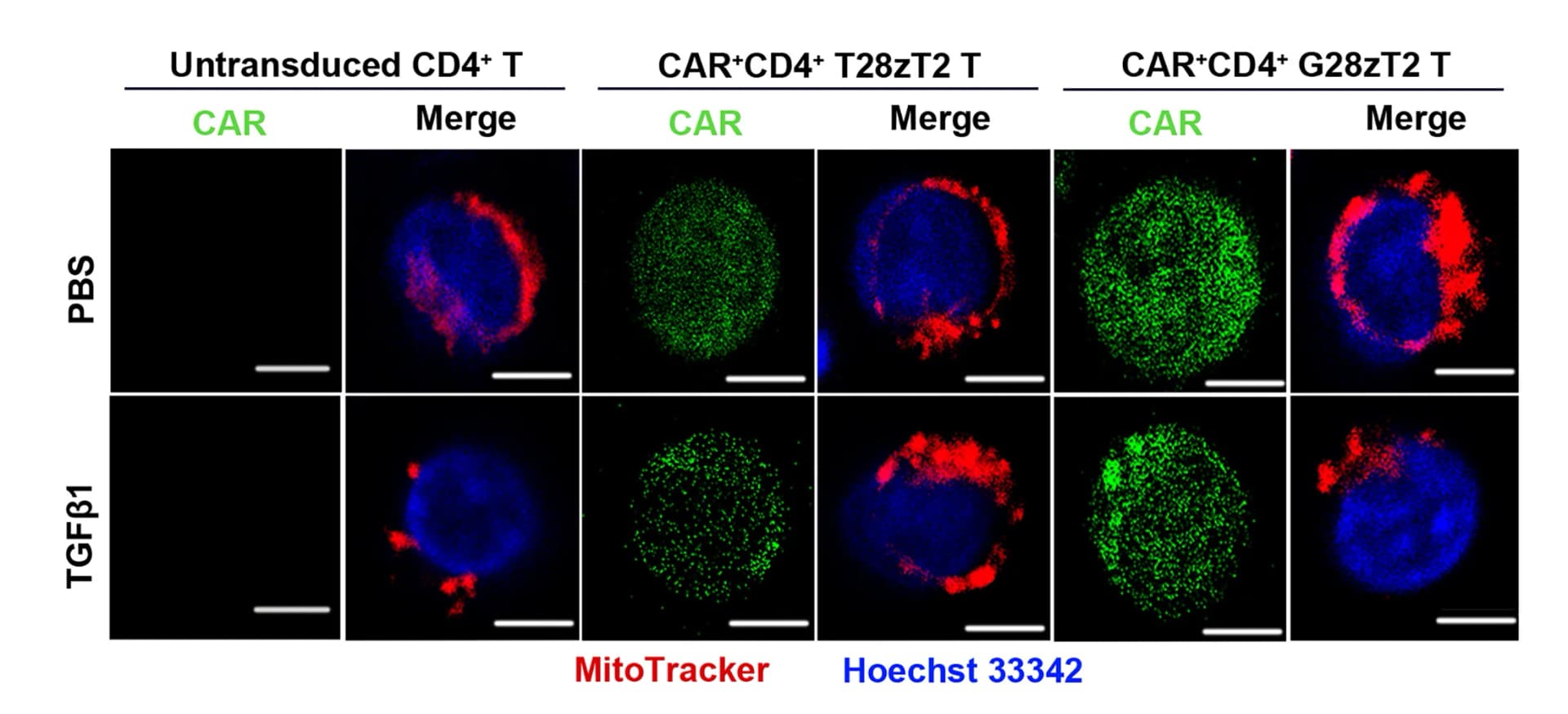Open access visualization of Microscopy, Mitochondrial Morphology, CAR+CD4+T28zT2, CAR+CD4+G28zT2, CD4+ T Cells