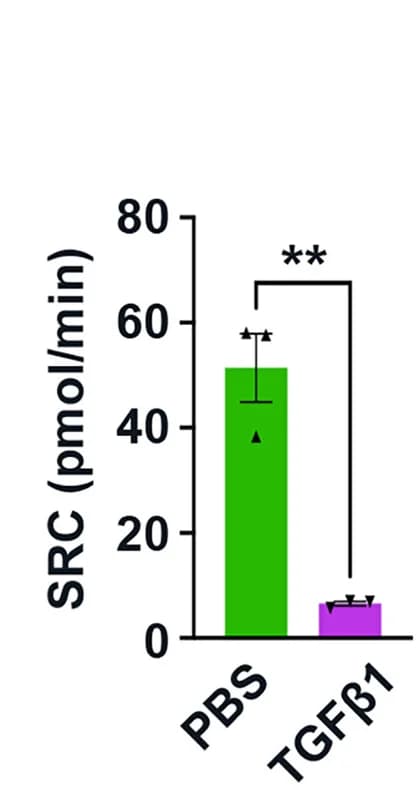 Open access visualization of Bar Plot, Error Bars, OCR Profile, ATP-coupled OCR, SRC