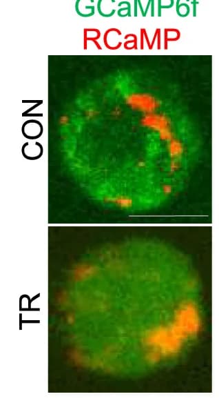 Open access visualization of Microscopy, Live-Cell Imaging, Calcium Imaging, GCaMP6f, RCaMP