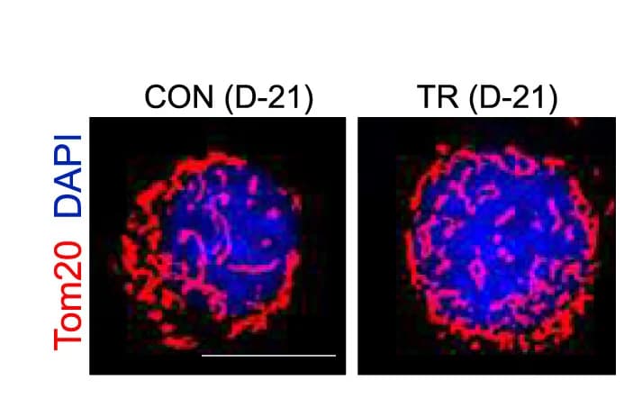 Open access visualization of Microscopy, Immunofluorescence, Tom20, Mitochondrial Shape, CAR T Cells