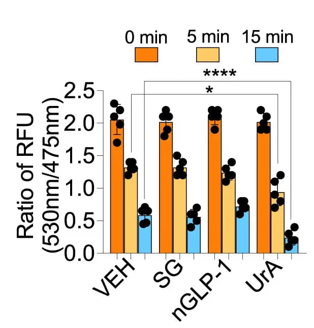 Open access visualization of Bar Plot, Error Bars, Scatter Plot, FRET Analysis, CFP-LC3-YFP