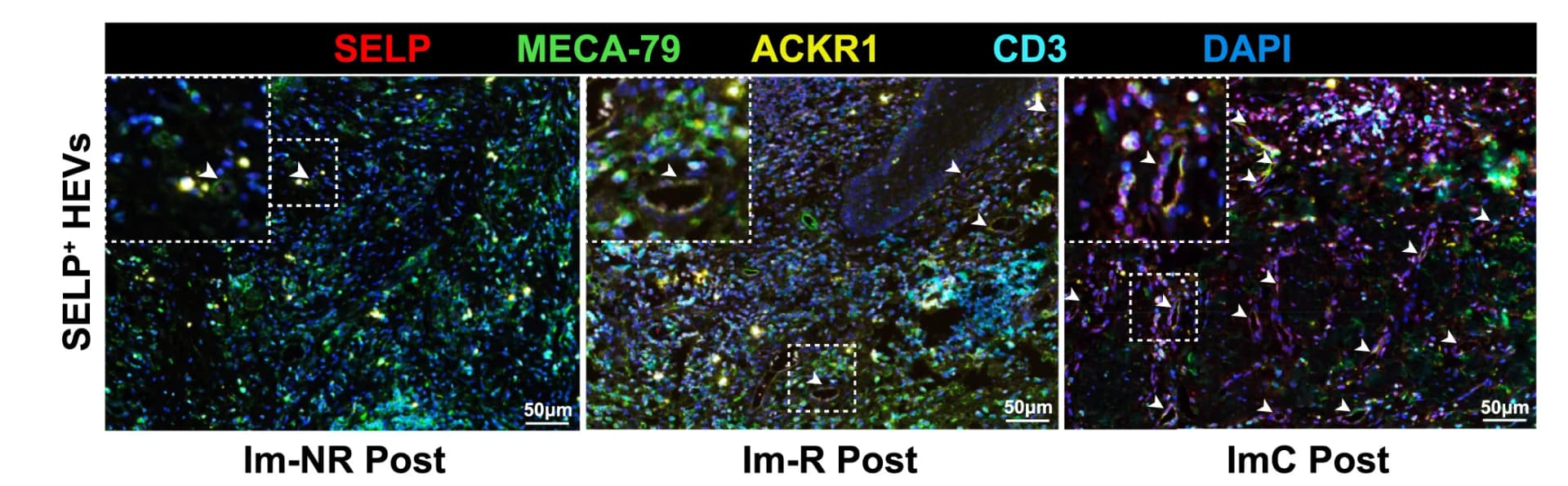 Open access visualization of Microscopy, Photo, mIHC Staining, SELP+HEVs, Post-Treatment Samples