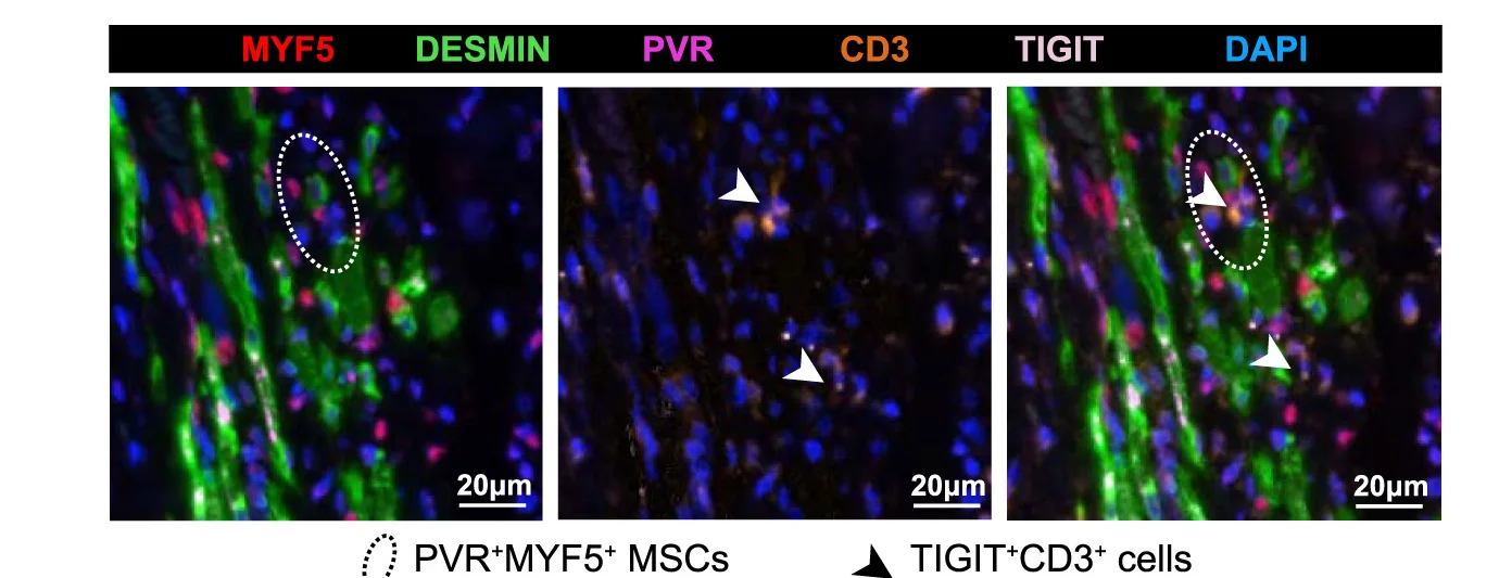 Open access visualization of Microscopy, PVR+MYF5+MSCs, TIGIT+CD3+Cells, Immunofluorescence Image