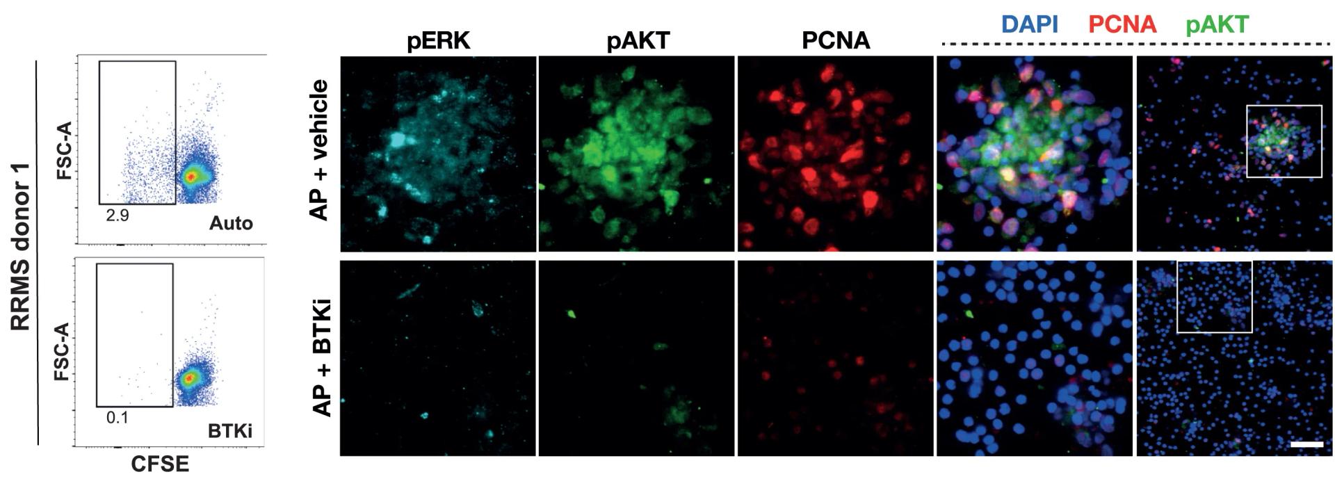 Open access visualization of Microscopy, Scatter Plot, AP Response, Vehicle, BTK Inhibitor
