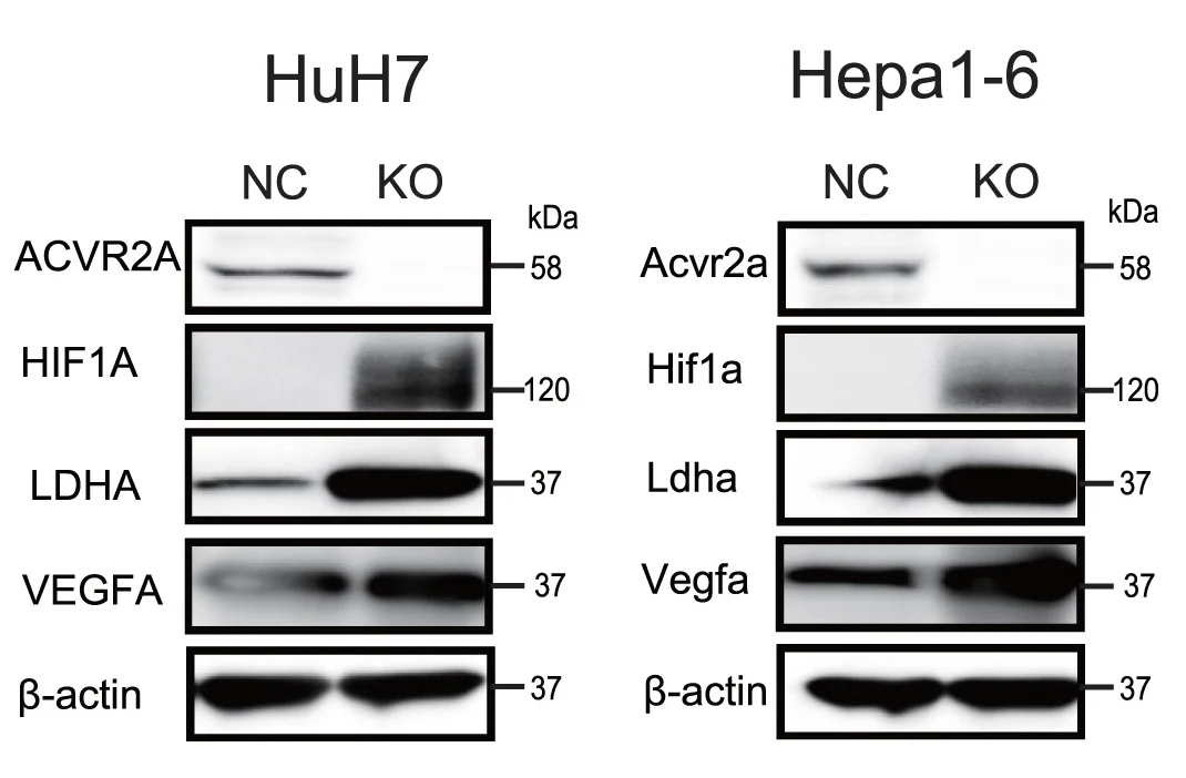 Open access visualization of Gel, Western Blot, Hypoxia, Glycolysis, Beta-Actin