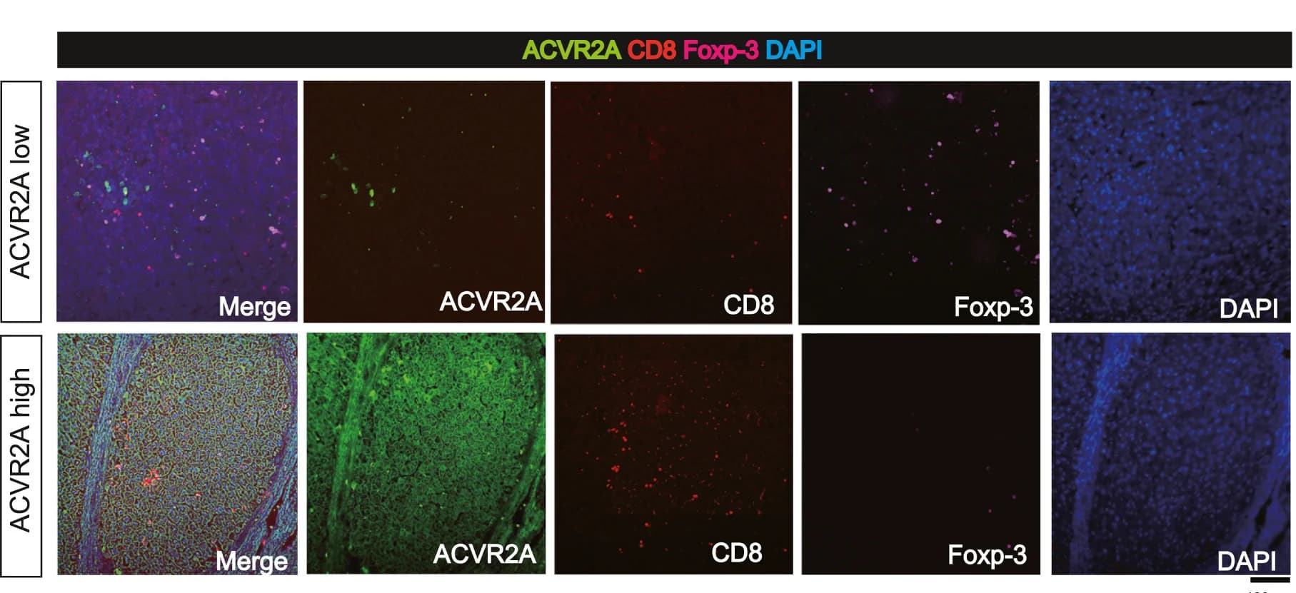 Open access visualization of Microscopy, Immunofluorescence, ACVR2A, CD8, Foxp-3