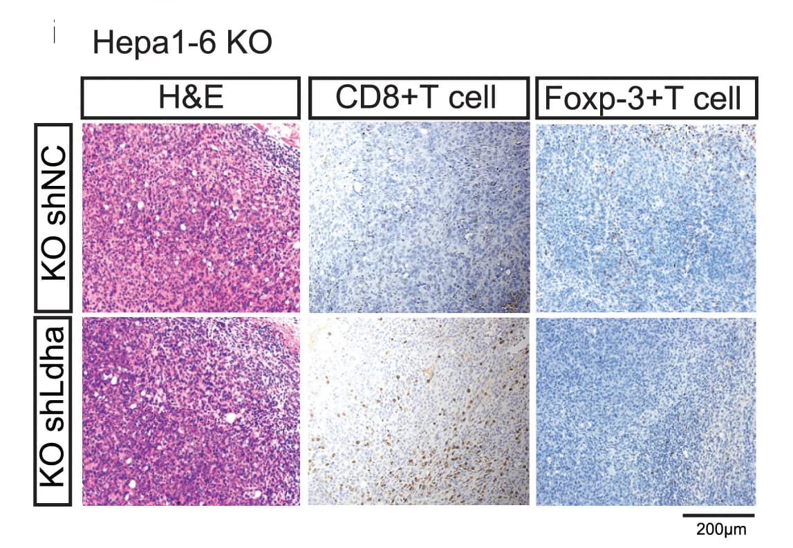 Open access visualization of Microscopy, Immunohistochemistry, CD8+ T Cells, Foxp-3+ T Cells, Hematoxylin