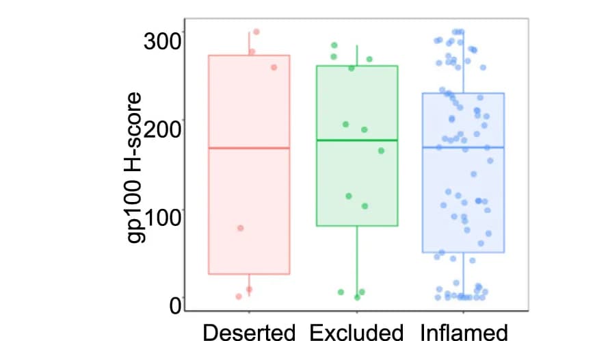 Open access visualization of Box Plot, Scatter Plot, gp100 Protein, Tumor Cells, T Cell Infiltration