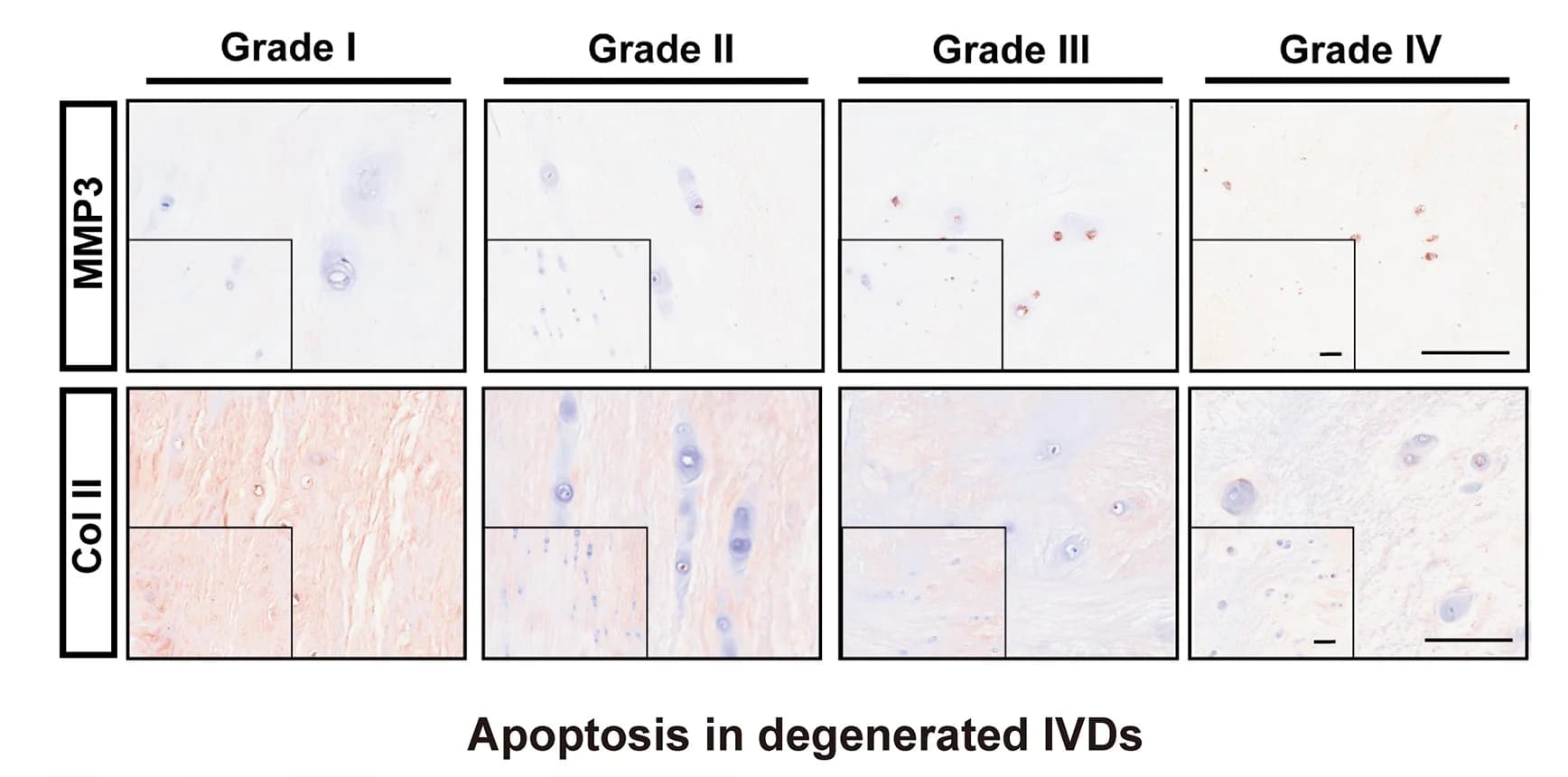 Open access visualization of Microscopy, IHC Staining, MMP3, Collagen Type II, NP Tissues