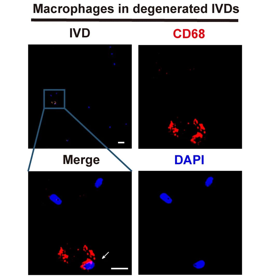 Open access visualization of Microscopy, IF Staining, CD68, Macrophages, IVDs