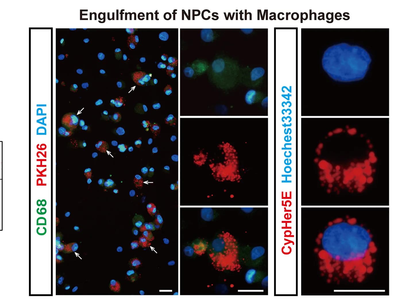 Open access visualization of Microscopy, CD68 Staining, Hoechest33342, TDMs, PKH26