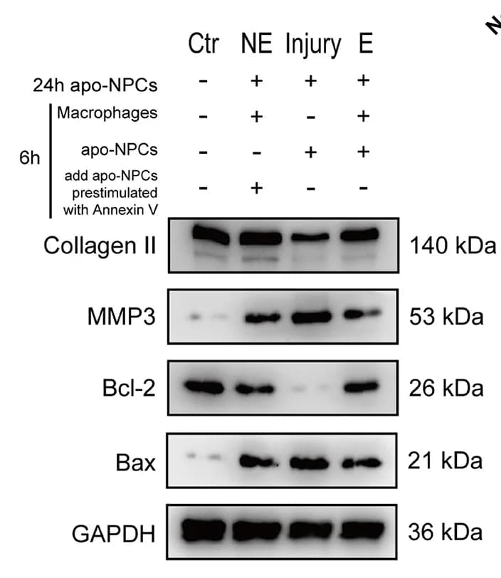 Open access visualization of Gel, Western Blots, Bax, Bcl-2, MMP3