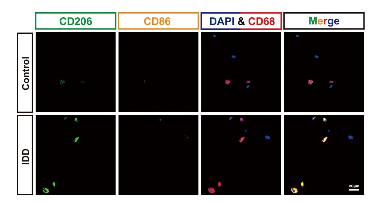 Open access visualization of Microscopy, IF Staining, CD68, CD86, CD206