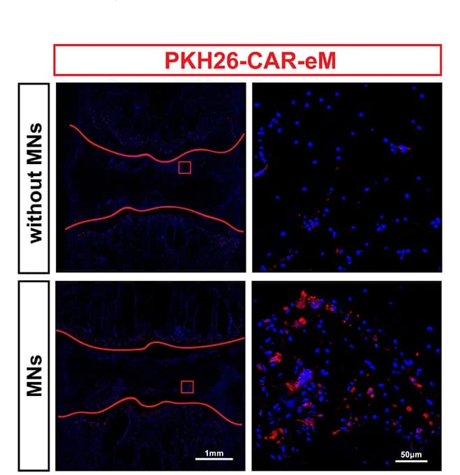 Open access visualization of Microscopy, Fluorescence Images, PKH-26-Labeled CAR-eM, Macrophages Localization, Coccygeal IVDs