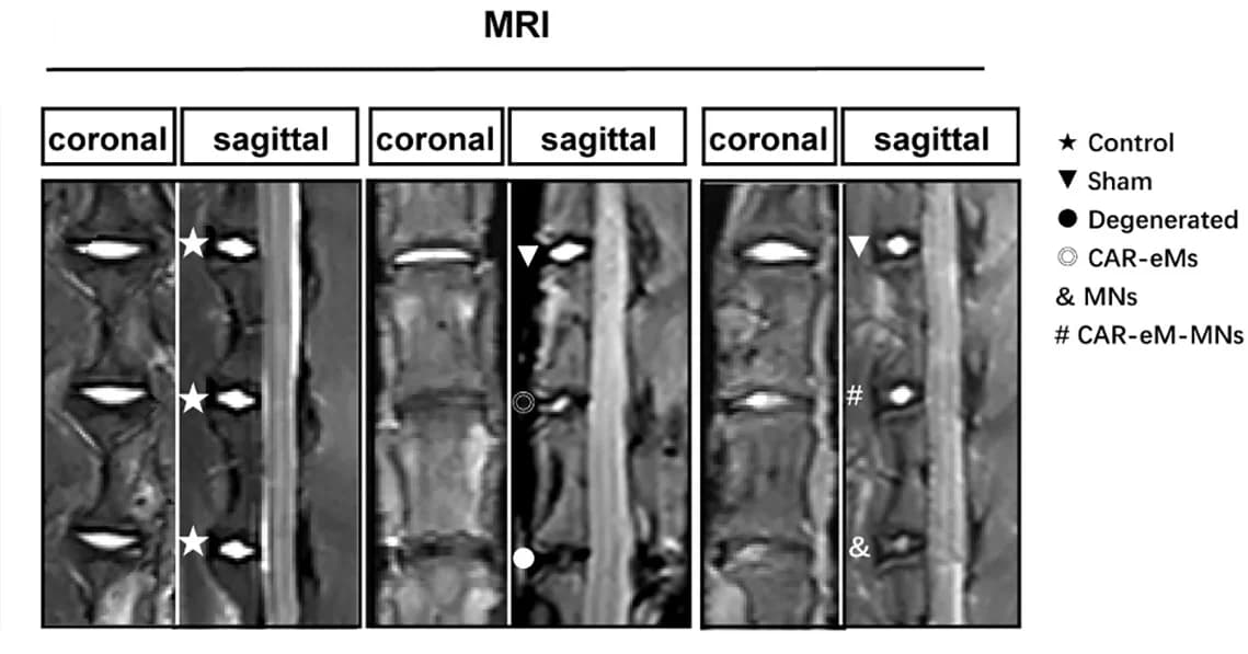 Open access visualization of Photo, Microscopy, Disc Height Index, Rabbit Lumbar IVDs, Groups