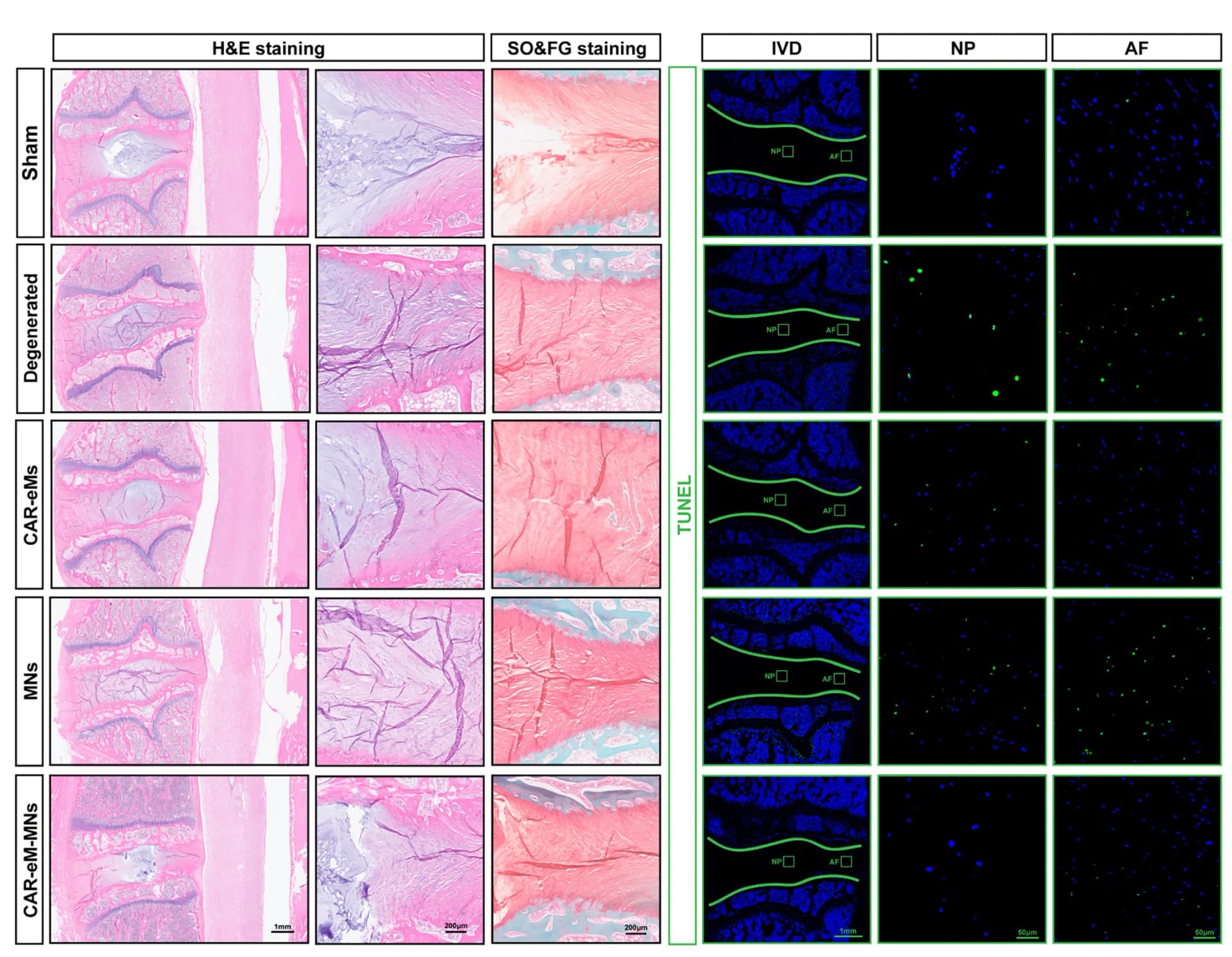 Open access visualization of Microscopy, H&E Staining, SO&FG Staining, TUNEL Staining, Rabbit Lumbar IVDs
