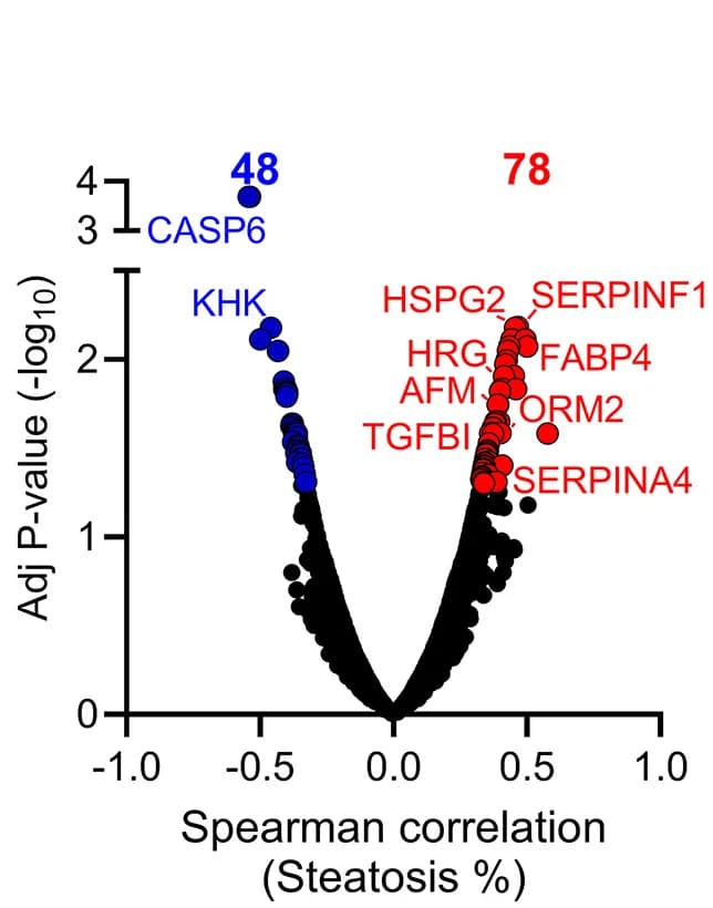 Open access visualization of Volcano Plot, Scatter Plot, Spearman Correlation Analysis, Liver Secreted Proteins, Liver Steatosis