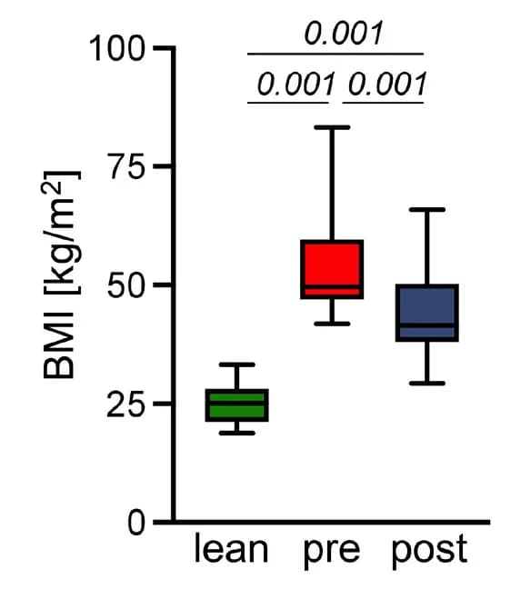 Open access visualization of Box Plot, BMI, Bariatric Surgery, Lean Control Patients
