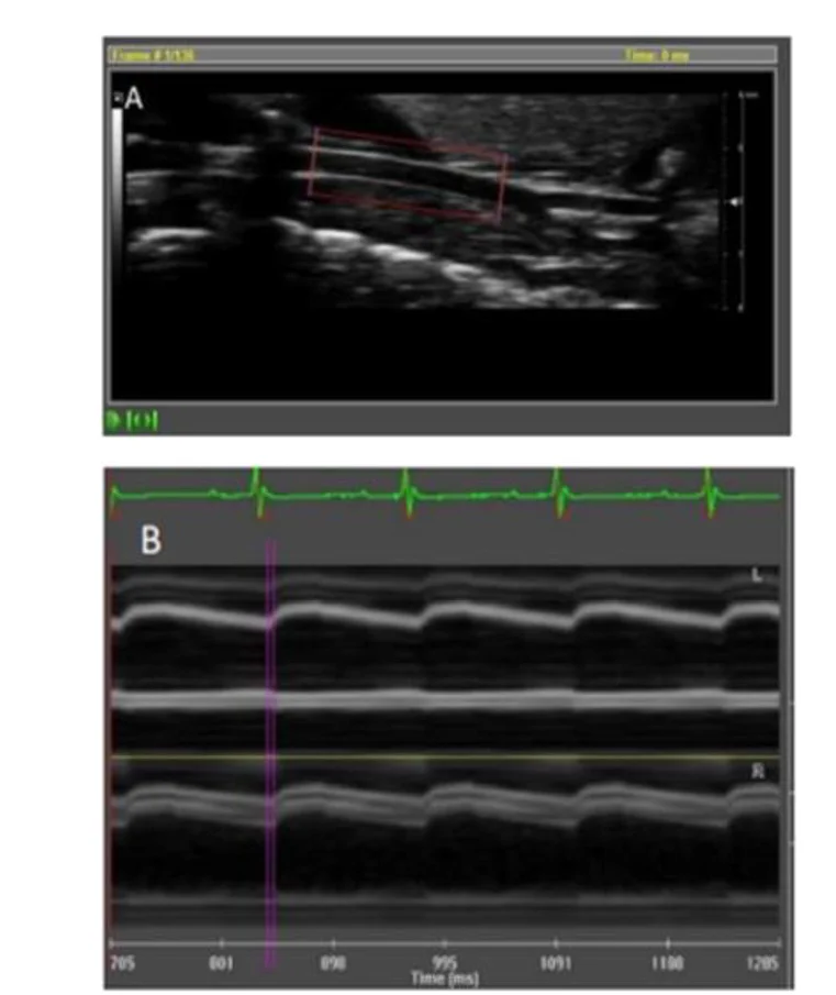 Open access visualization of Microscopy, Line Plot, Vascular Ultrasound, Carotid Arteries
