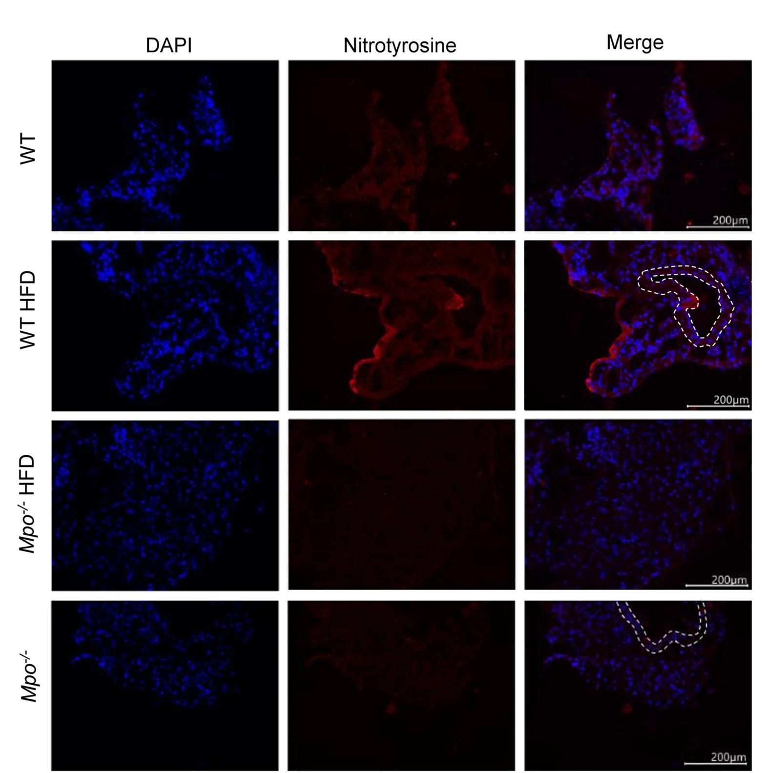 Open access visualization of Microscopy, Immunohistochemistry, Nitrosative Tissue Damage, PVAT, Obese Mice