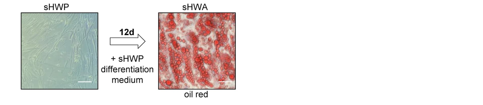 Open access visualization of Microscopy, Subcutaneous Human White Preadipocytes, Adipocytes, Lipid Vacuole Formation, Oil Red O Staining