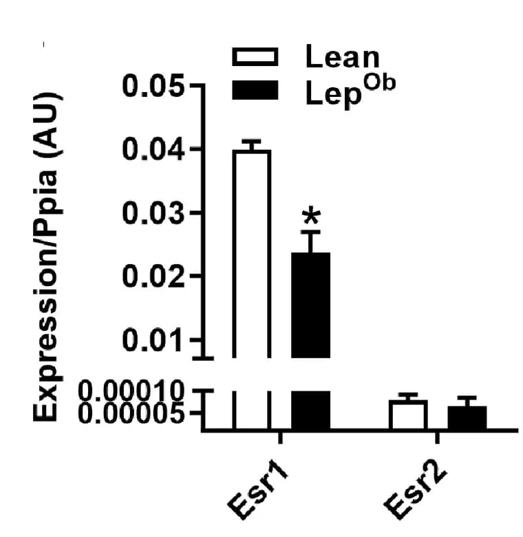 Open access visualization of Bar Plot, Error Bars, Clustered, Muscle, Esr1