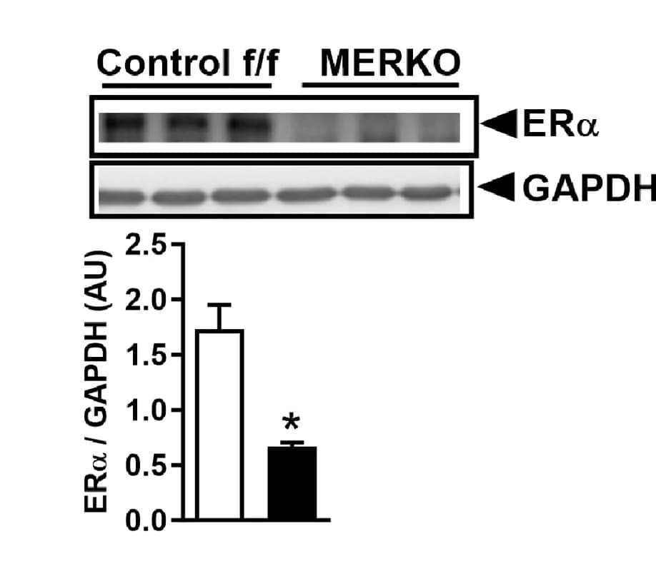 Open access visualization of Bar Plot, Error Bars, Gel, Esr1, Protein