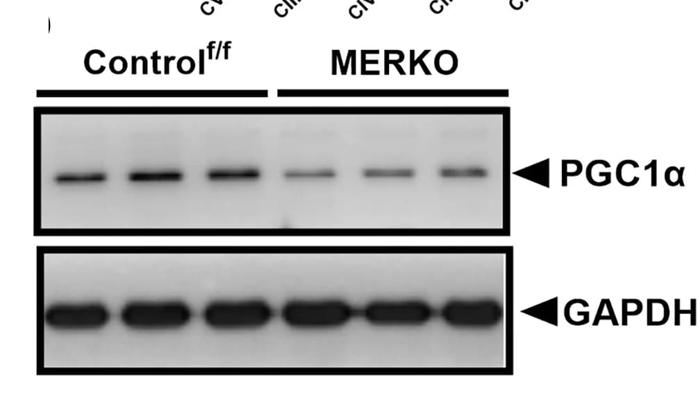 Open access visualization of Gel, Immunoblot, Densitometry, Muscle PGC1alpha, Control Mice
