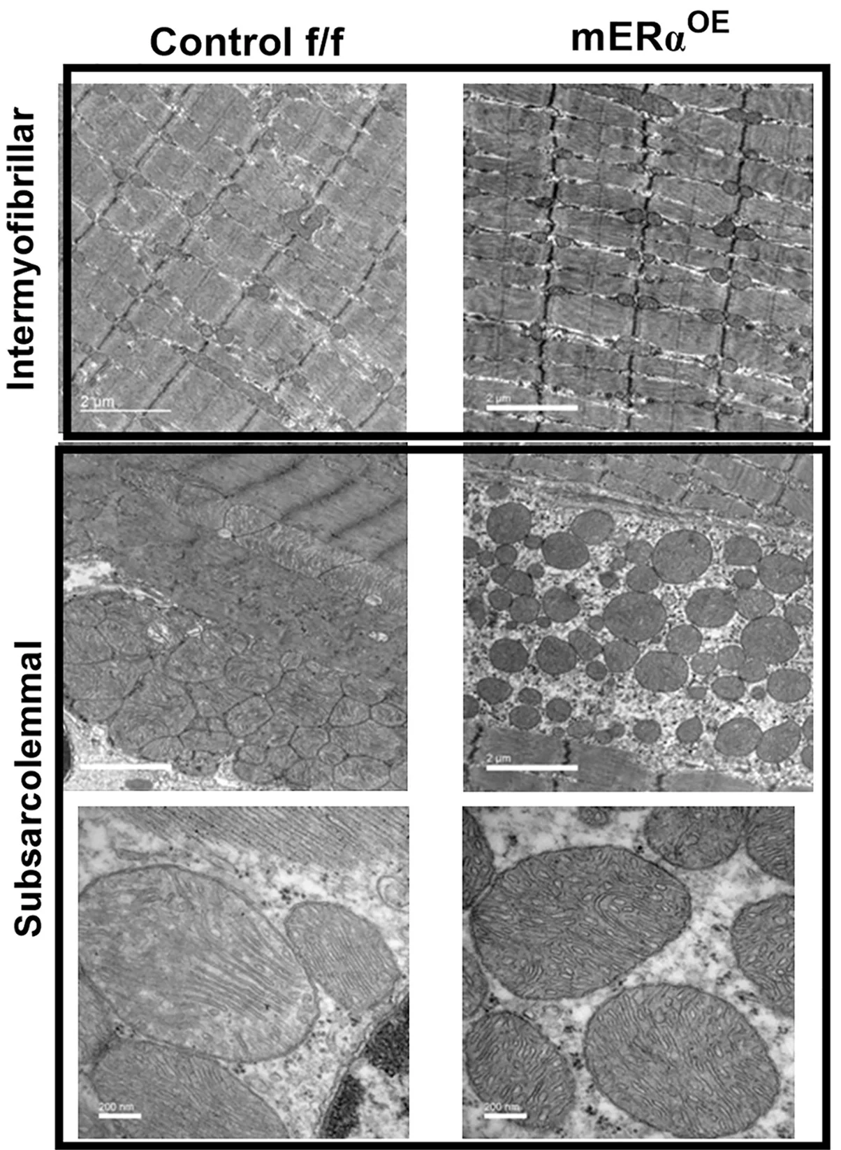 Open access visualization of Microscopy, Photo, Transmission Electron Microscopy, Muscle, mERalphaOE