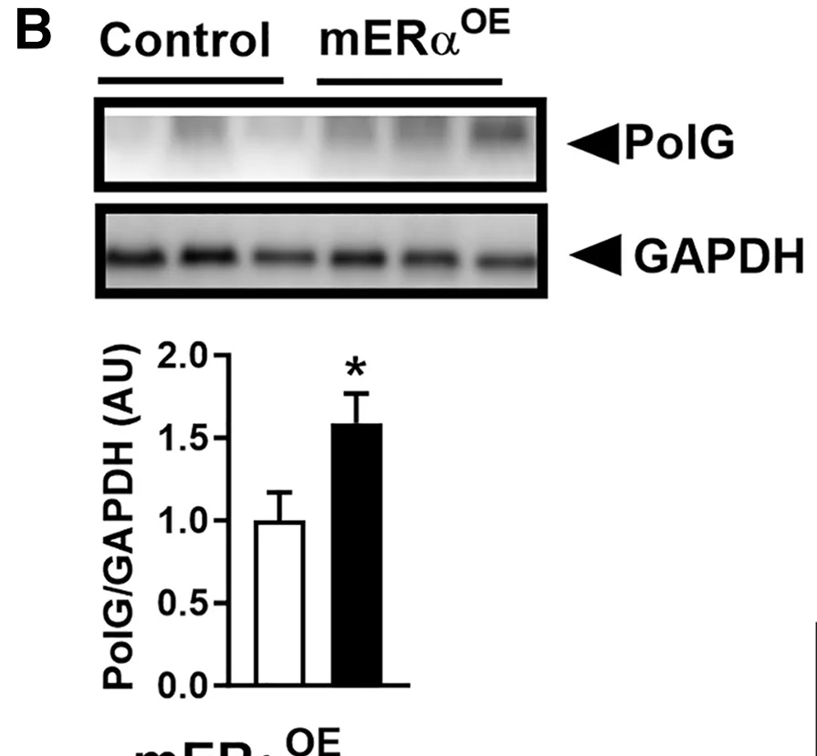 Open access visualization of Bar Plot, Error Bars, Gel, Hindlimb Muscles, mERalphaOE