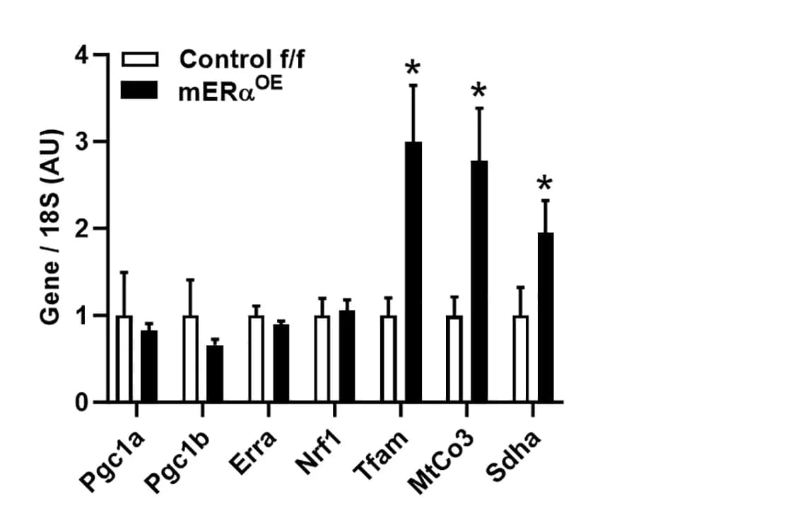Open access visualization of Bar Plot, Error Bars, Clustered, Transcript Expression, Skeletal Muscle