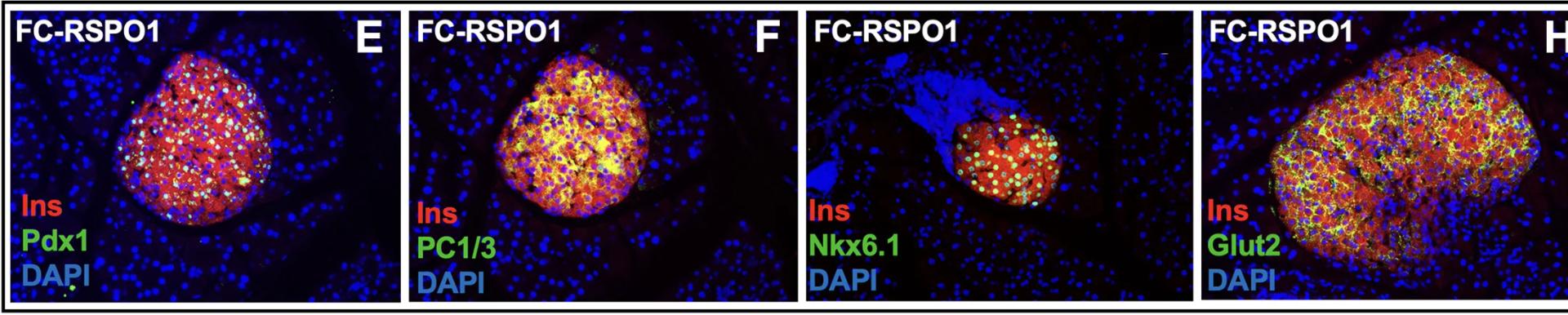 Open access visualization of Microscopy, Pancreatic Sections, FC-RSPO1, NOD Mice, Beta Cell Markers