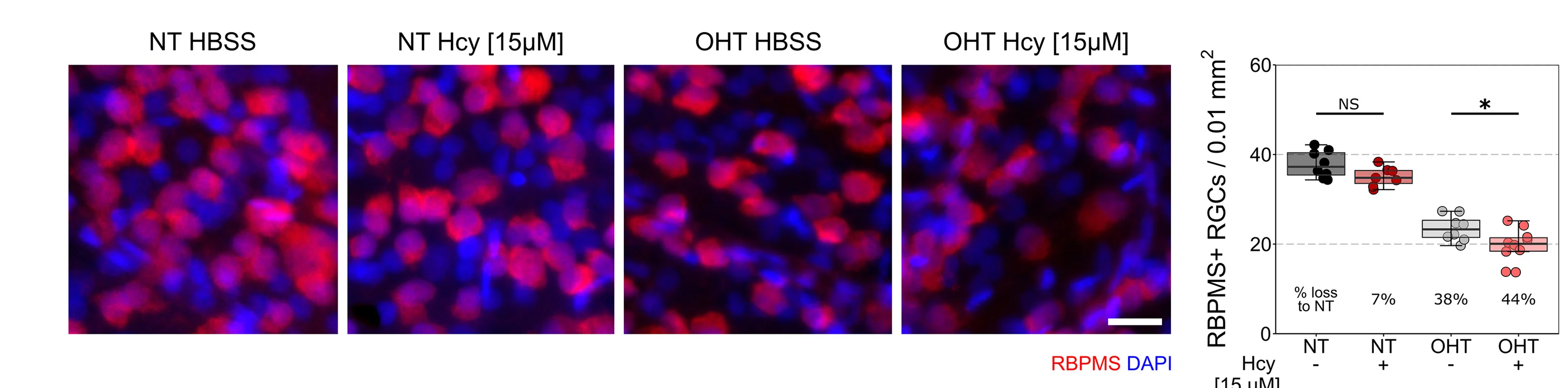 Open access visualization of Microscopy, Box Plot, Scatter Plot, Homocysteine, Retinal Ganglion Cell Density
