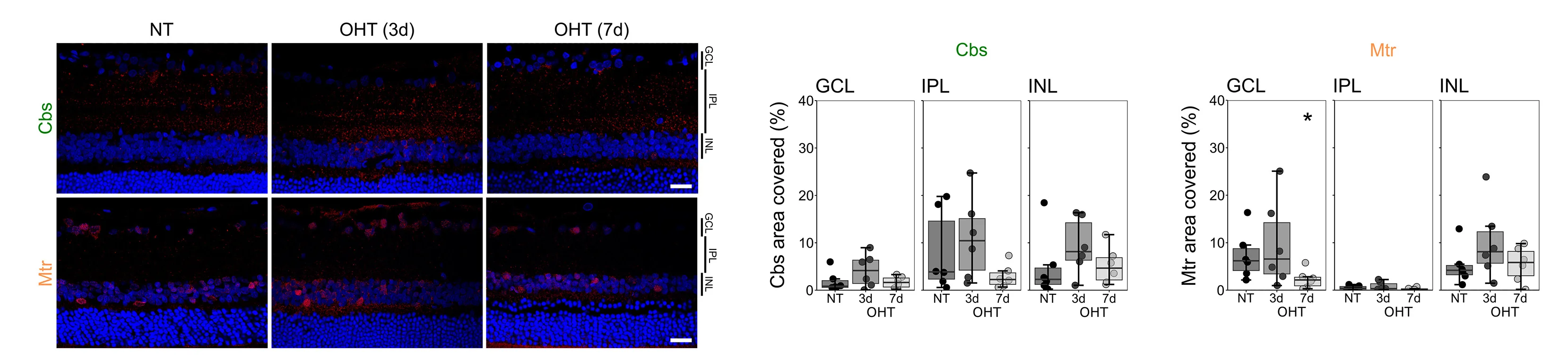 Open access visualization of Microscopy, Box Plot, Retina, Cbs, Inner Retina