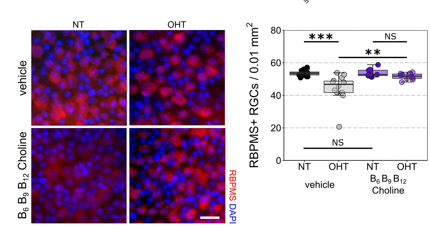 Open access visualization of Box Plot, Scatter Plot, Neuroprotection, RGCs, Vitamin B6